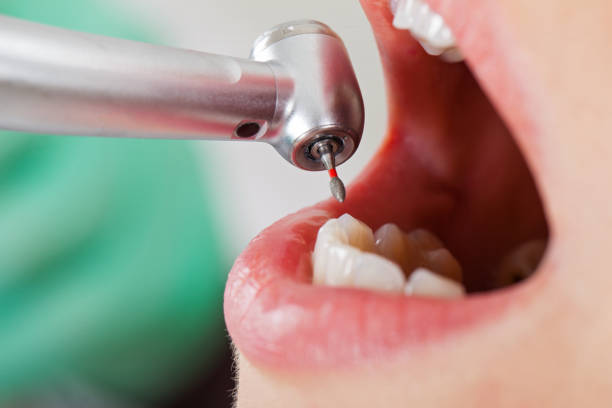 Best Emergency Treatment for Dental Infections or Abscesses in St Albans, WV